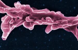 L’OMS annonce la première préqualification d’un test de diagnostic de la tuberculose